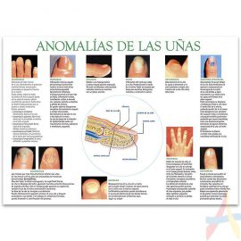 Anomalía de la uñas