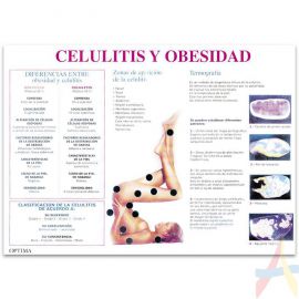 Celulitis y obesidad